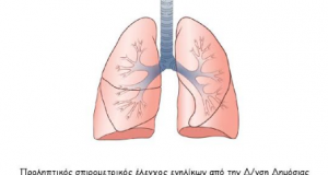 spirometrisi kapi vonitsas