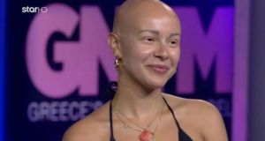 gntm ludia alopekia