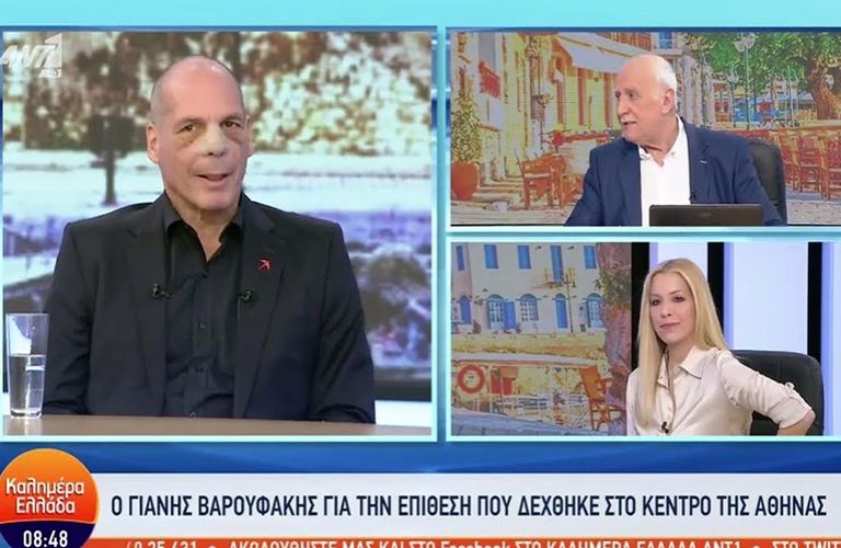 varoufakis epithesi